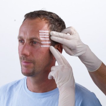 Hartmann Omnistrip® Wound Closure Adhesive Tapes.  Hartmann Omnistrip® Wound Closure Adhesive Tapes.