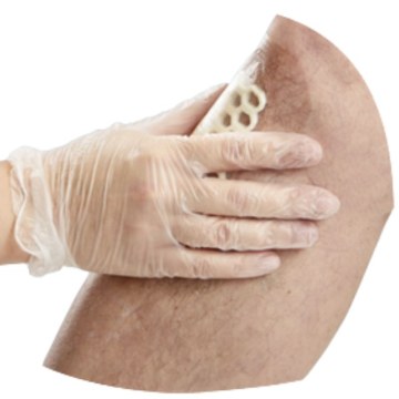 Post Surgical Dressing