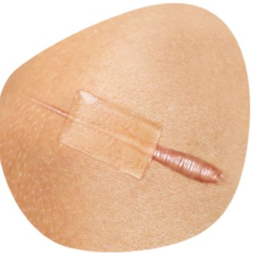 cica care silicone sheet