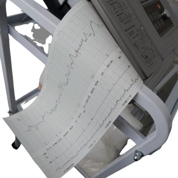Electrocardiographs