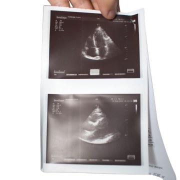 Ultrasound Paper