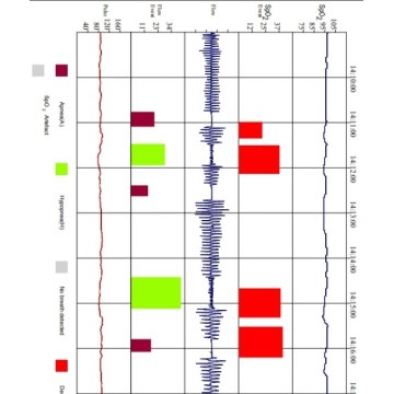 Μόνιτορ Υπνικής Άπνοιας CONTEC – δείγμα report (γράφημα συμβάντων)