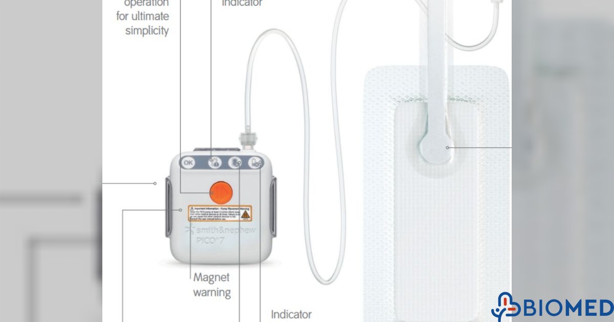 Biomed Gr PICO 7 sNPWT – Single-use NPWT system for closed incisions & wounds ...
