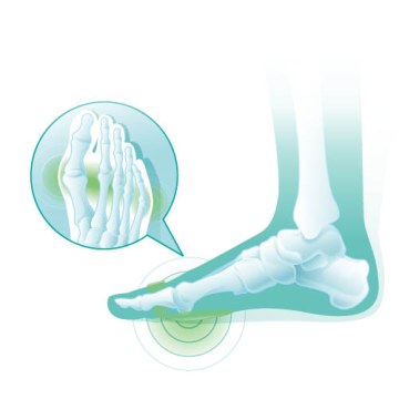Oppo 6442 Anatomical Metatarsal Pads