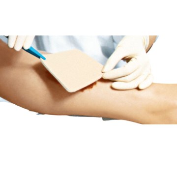 Pressure Ulcer Dressings